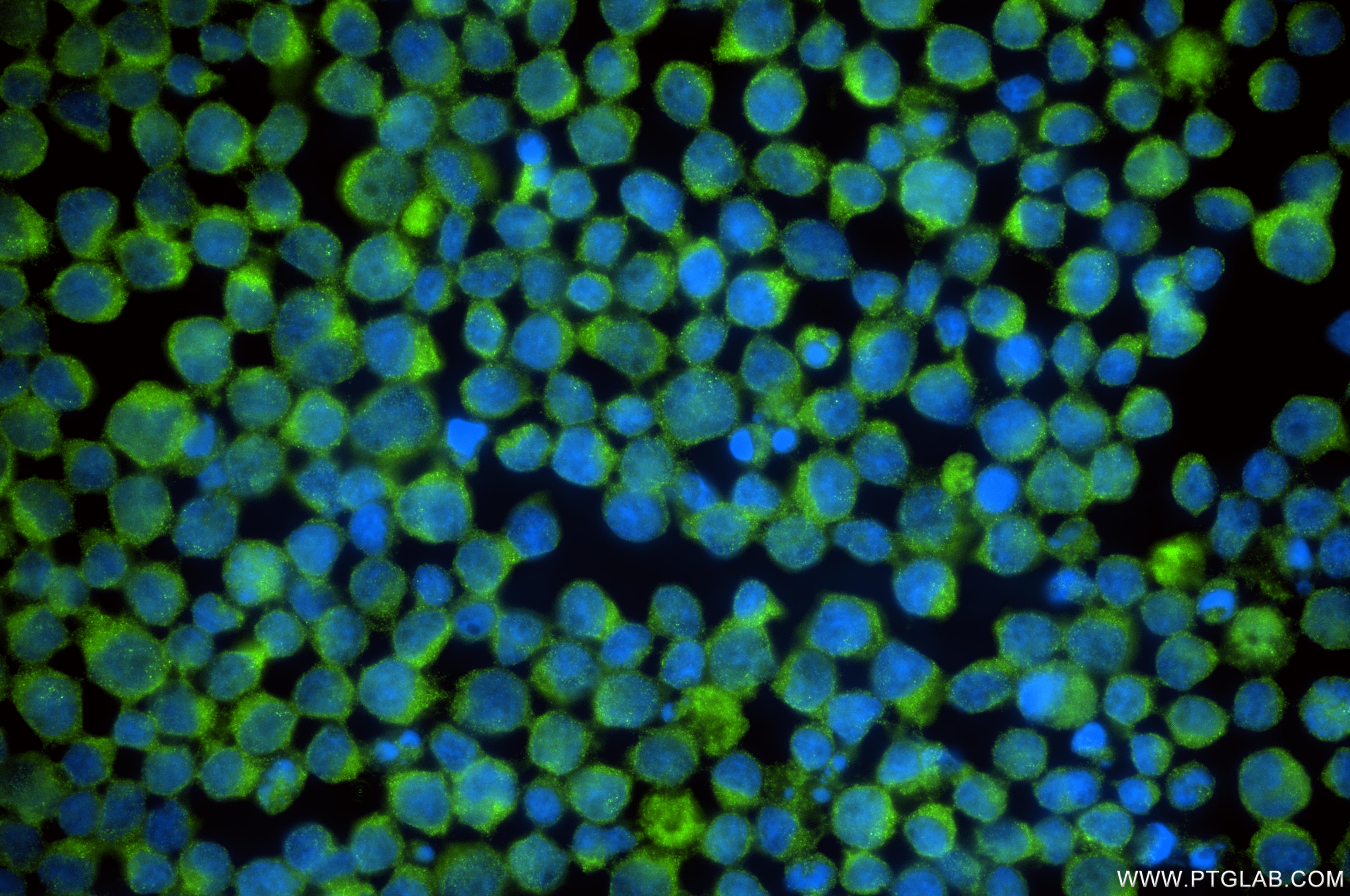 Immunofluorescent analysis of (4% PFA) fixed Jurkat cells using DCUN1D1 antibody (85849-4-RR, Clone: 250196B5 ) at dilution of 1:400 and CoraLite®488-Conjugated Goat Anti-Rabbit IgG(H+L) (SA00013-2). Immunofluorescence (IF) / fluorescent staining of Jurkat cells using DCUN1D1 Recombinant monoclonal antibody (85849-4-RR)