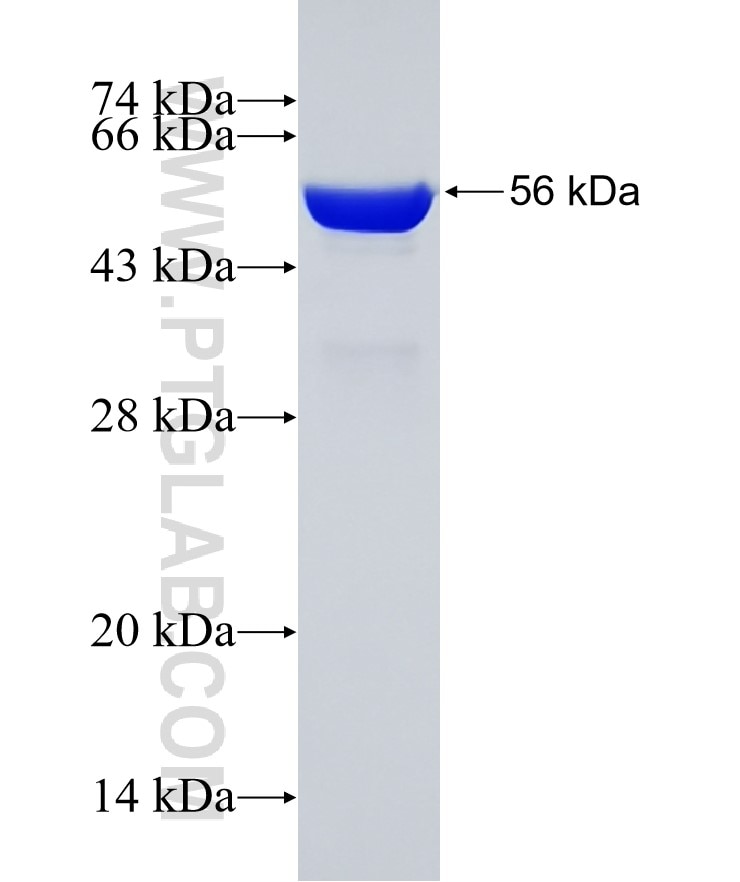 DCUN1D1 fusion protein Ag1440 SDS-PAGE