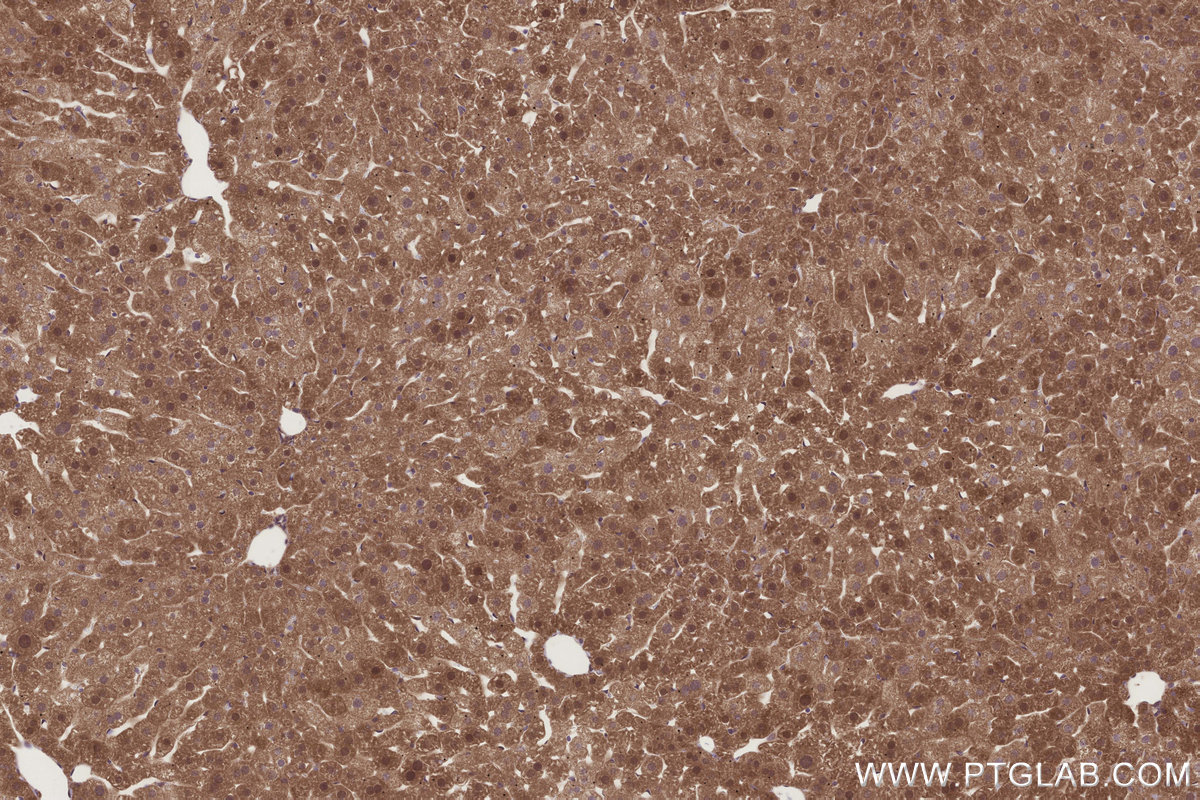IHC staining of mouse liver using 31696-1-AP Immunohistochemistry (IHC) staining of mouse liver tissue using DCUN1D2 Polyclonal antibody (31696-1-AP)