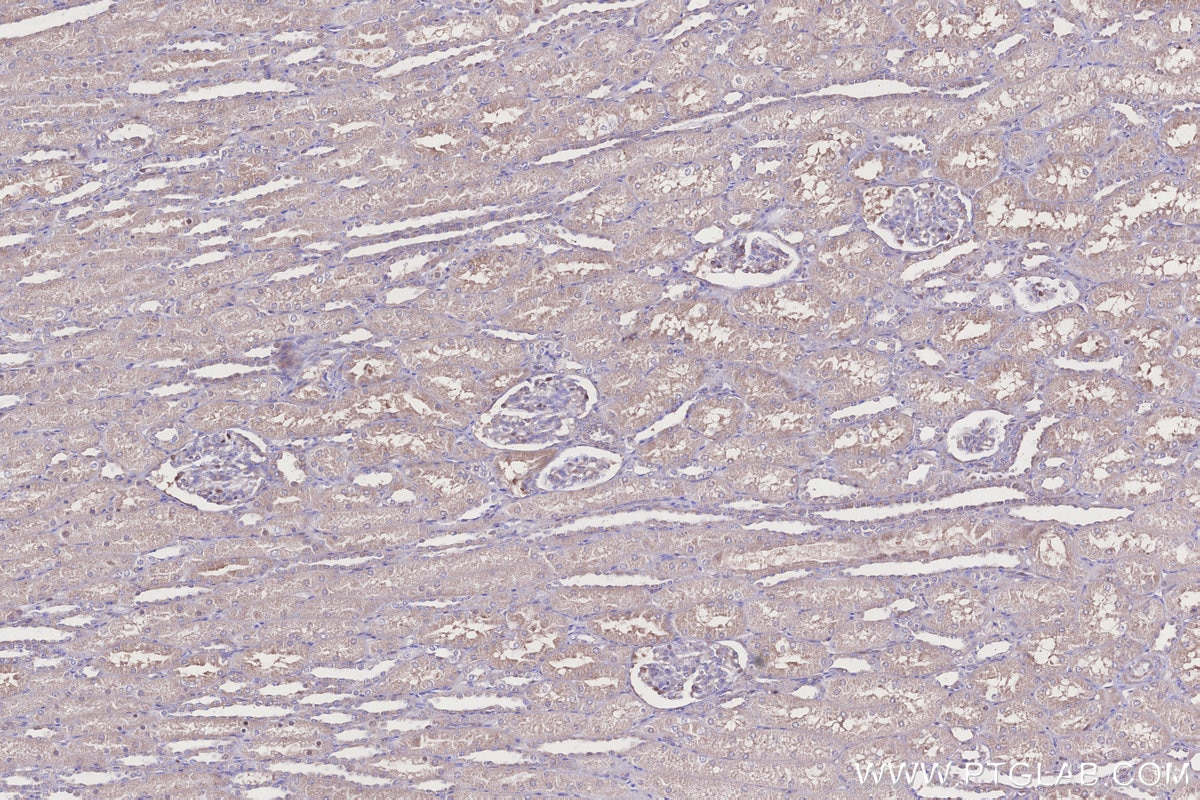 IHC staining of human kidney using 31696-1-AP Immunohistochemistry (IHC) staining of human kidney tissue using DCUN1D2 Polyclonal antibody (31696-1-AP)