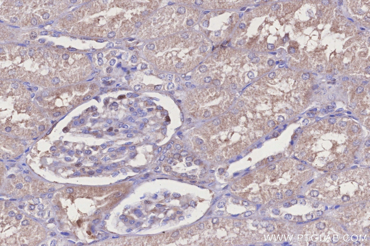 IHC staining of human kidney using 31696-1-AP Immunohistochemistry (IHC) staining of human kidney tissue using DCUN1D2 Polyclonal antibody (31696-1-AP)