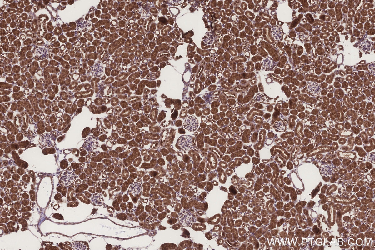IHC staining of mouse kidney using 31696-1-AP Immunohistochemistry (IHC) staining of mouse kidney tissue using DCUN1D2 Polyclonal antibody (31696-1-AP)