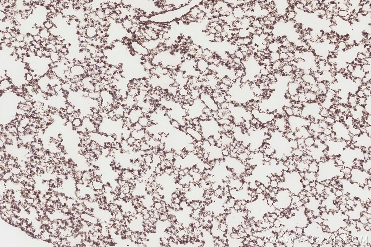 IHC staining of mouse lung using 31696-1-AP Immunohistochemistry (IHC) staining of mouse lung tissue using DCUN1D2 Polyclonal antibody (31696-1-AP)