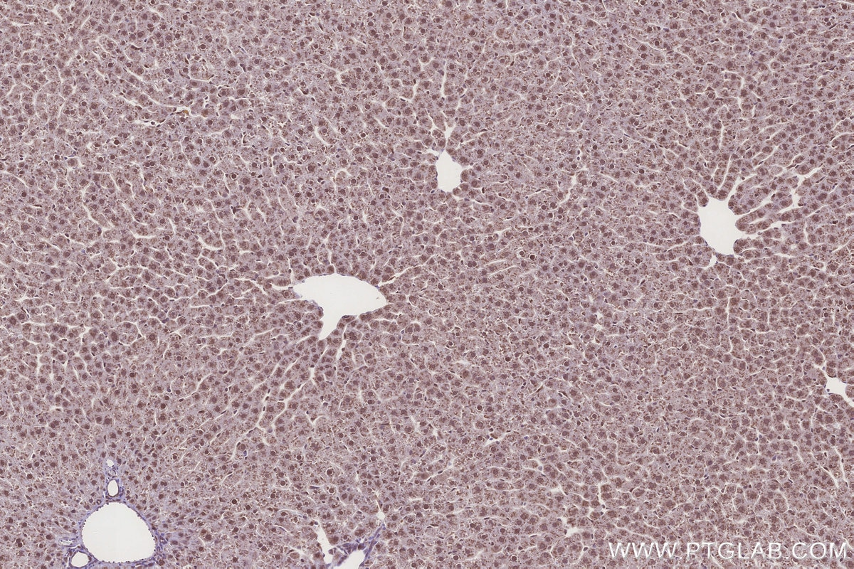 IHC staining of rat liver using 31696-1-AP Immunohistochemistry (IHC) staining of rat liver tissue using DCUN1D2 Polyclonal antibody (31696-1-AP)