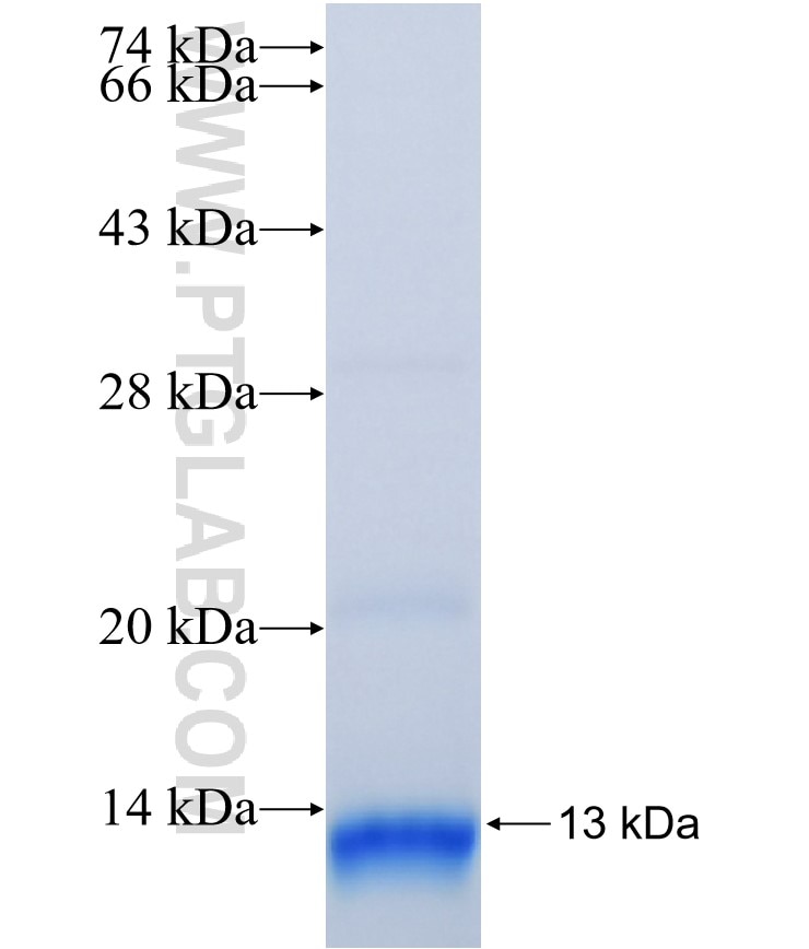 DCUN1D2 fusion protein Ag36330 SDS-PAGE DCUN1D2 fusion protein Ag36330 SDS-PAGE