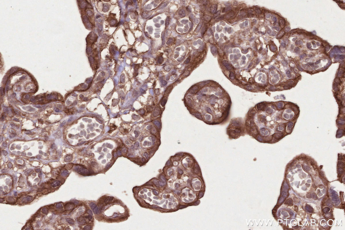 IHC staining of human placenta using 26356-1-AP Immunohistochemistry (IHC) staining of human placenta tissue using DCUN1D3 Polyclonal antibody (26356-1-AP)