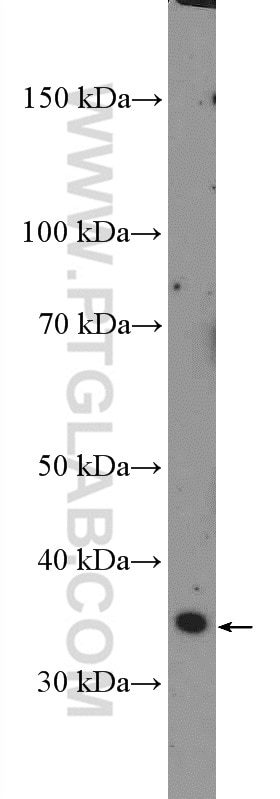 Western Blot (WB) analysis of A549 cells using DCUN1D3 Polyclonal antibody (26356-1-AP)