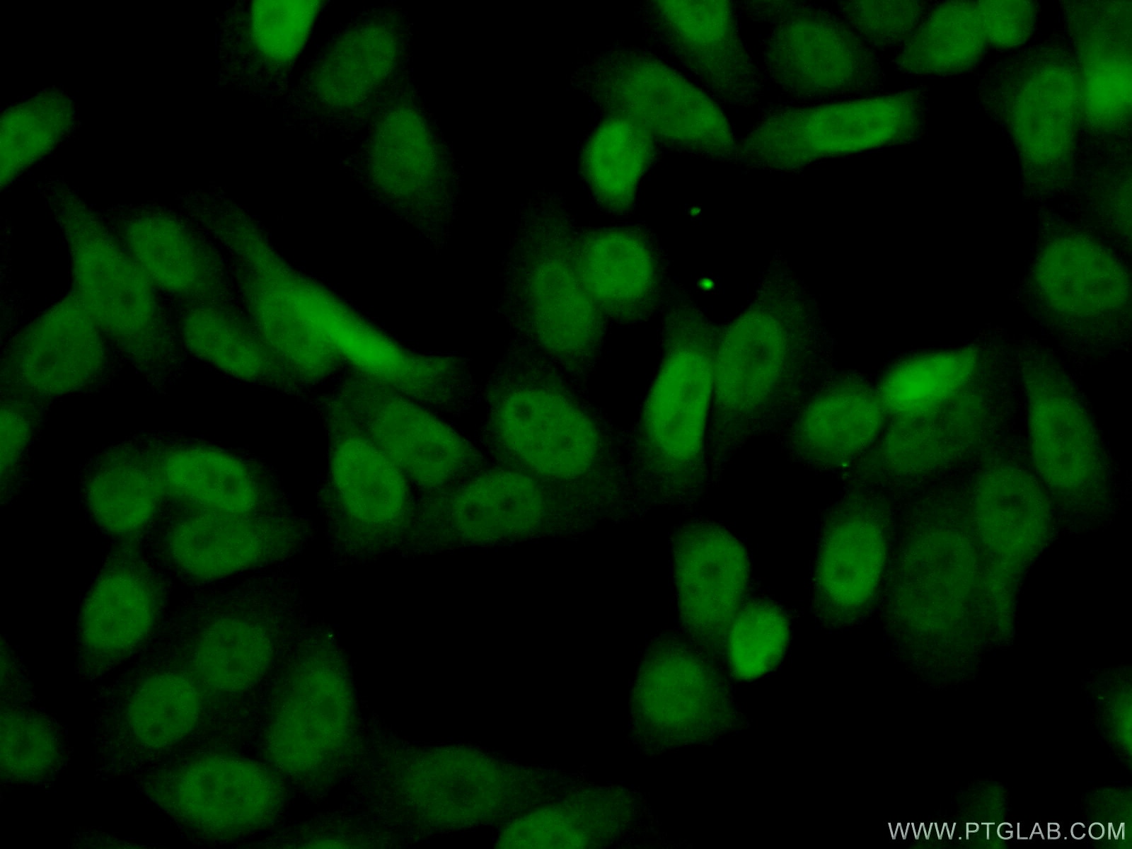 Immunofluorescence (IF) / fluorescent staining of HeLa cells using DCUN1D5 Polyclonal antibody (14810-1-AP)