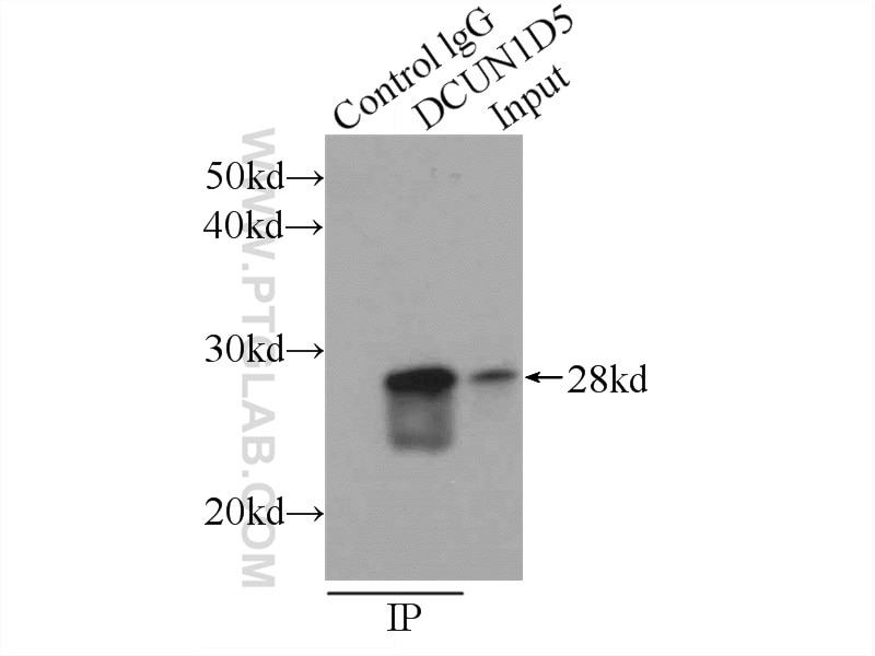 Immunoprecipitation (IP) experiment of HeLa cells using DCUN1D5 Polyclonal antibody (14810-1-AP)