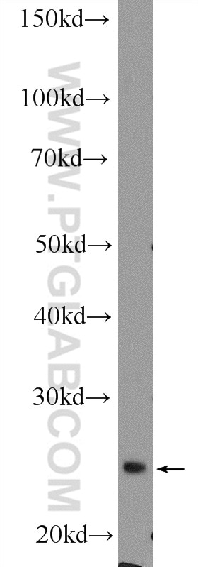 Western Blot (WB) analysis of mouse brain tissue using DCUN1D5 Polyclonal antibody (14810-1-AP)