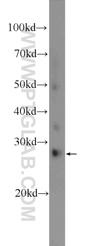 Western Blot (WB) analysis of rat spleen tissue using DCUN1D5 Polyclonal antibody (14810-1-AP)