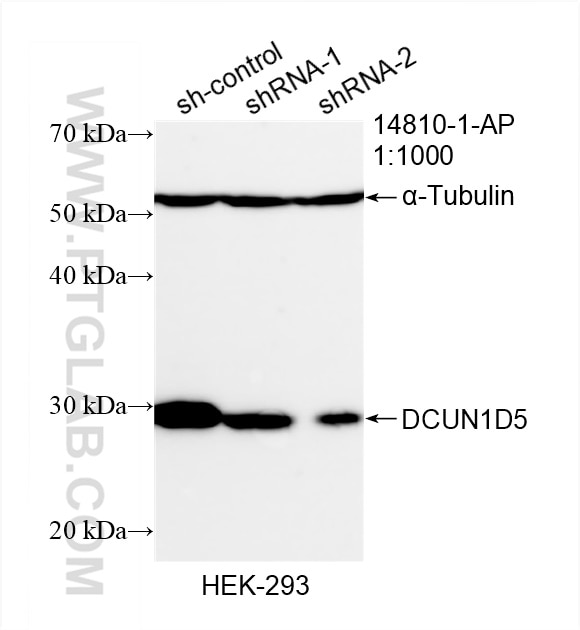 Western Blot (WB) analysis of HEK-293 cells using DCUN1D5 Polyclonal antibody (14810-1-AP)