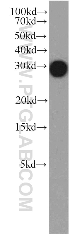 Western Blot (WB) analysis of HEK-293 cells using DCUN1D5 Polyclonal antibody (14810-1-AP)