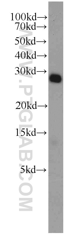 Western Blot (WB) analysis of U-937 cells using DCUN1D5 Polyclonal antibody (14810-1-AP)