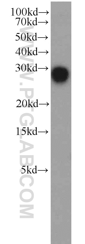 Western Blot (WB) analysis of HeLa cells using DCUN1D5 Polyclonal antibody (14810-1-AP)