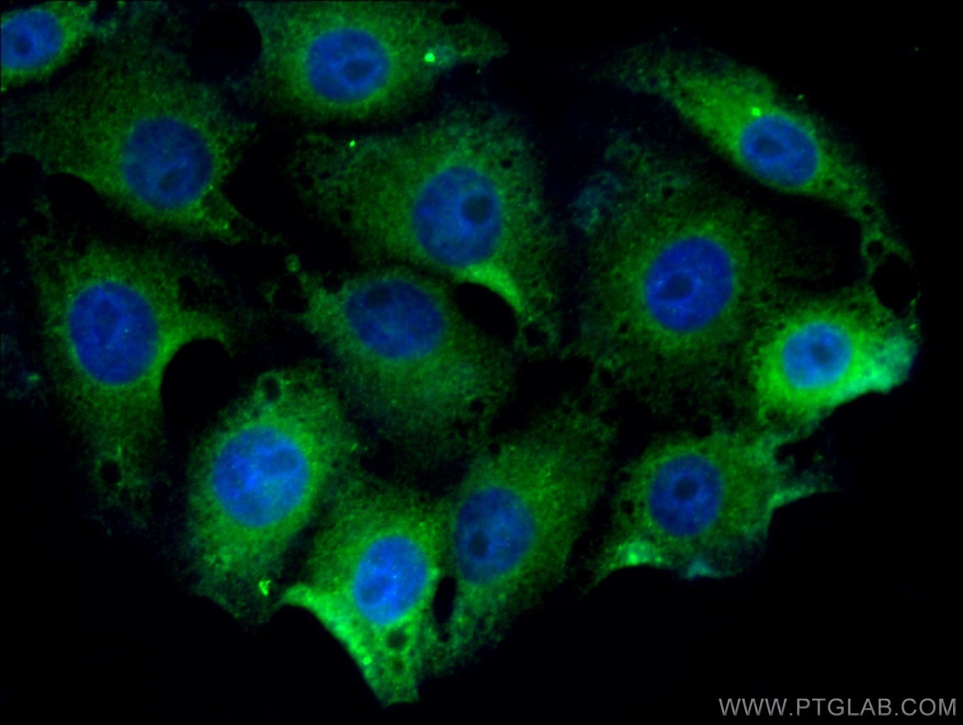 Immunofluorescence (IF) / fluorescent staining of SH-SY5Y cells using DCX Polyclonal antibody (13925-1-AP)