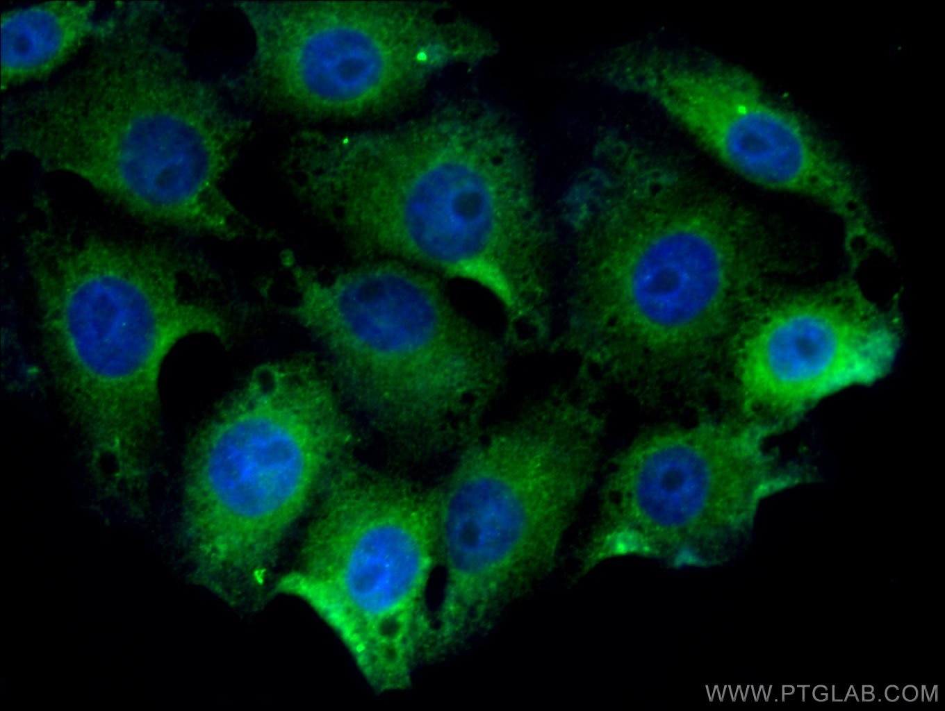 IF Staining of SH-SY5Y using 13925-1-AP