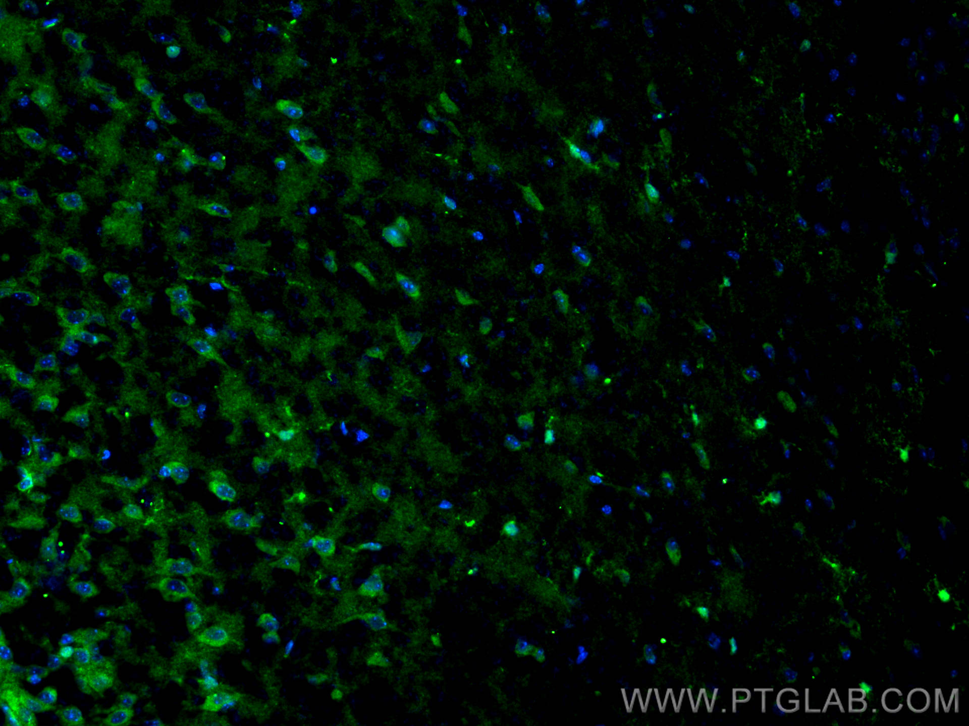 Immunofluorescence (IF) / fluorescent staining of mouse brain tissue using DCX Polyclonal antibody (13925-1-AP)