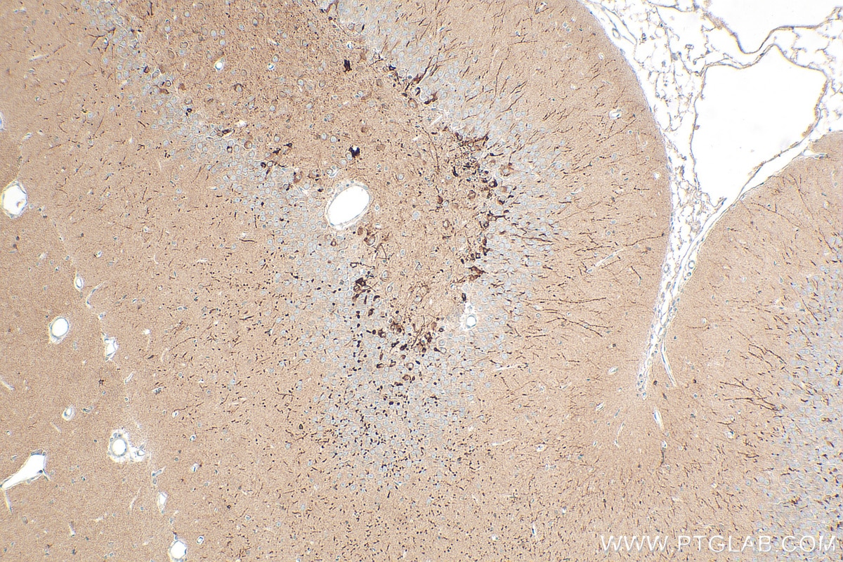 Immunohistochemistry (IHC) staining of rat brain tissue using DCX Polyclonal antibody (13925-1-AP)