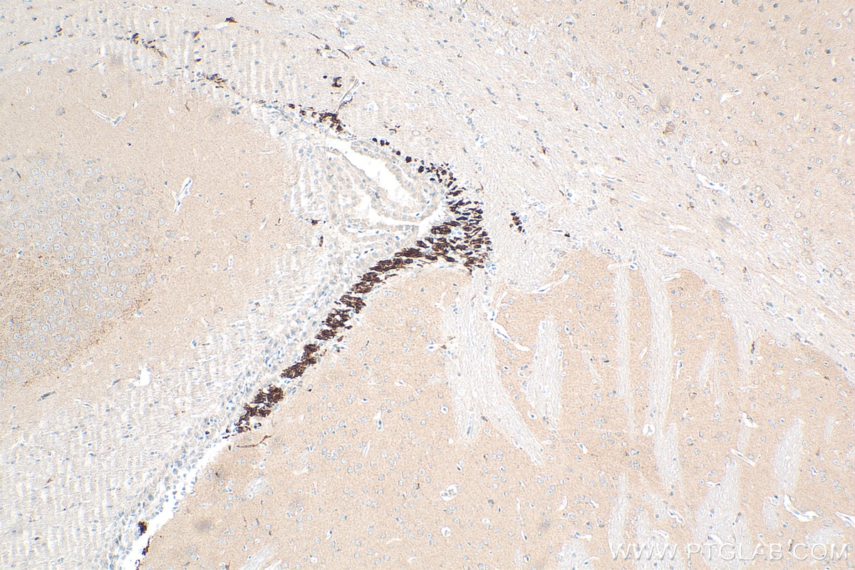 Immunohistochemistry (IHC) staining of mouse brain tissue using DCX Polyclonal antibody (13925-1-AP)