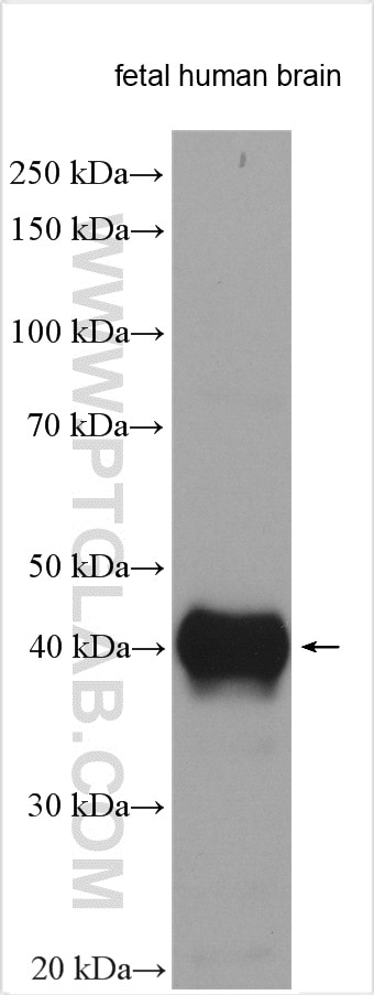 Western Blot (WB) analysis of various lysates using DCX Polyclonal antibody (13925-1-AP)