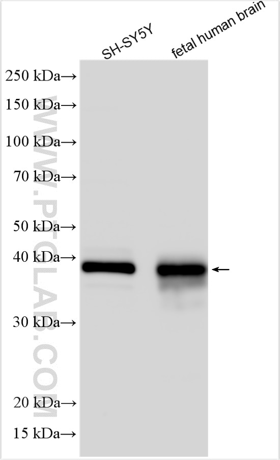 Western Blot (WB) analysis of various lysates using DCX Polyclonal antibody (13925-1-AP)