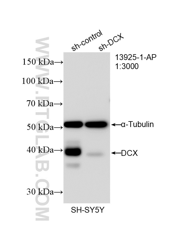 Western Blot (WB) analysis of SH-SY5Y cells using DCX Polyclonal antibody (13925-1-AP)