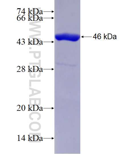 DCX fusion protein Ag29029 SDS-PAGE