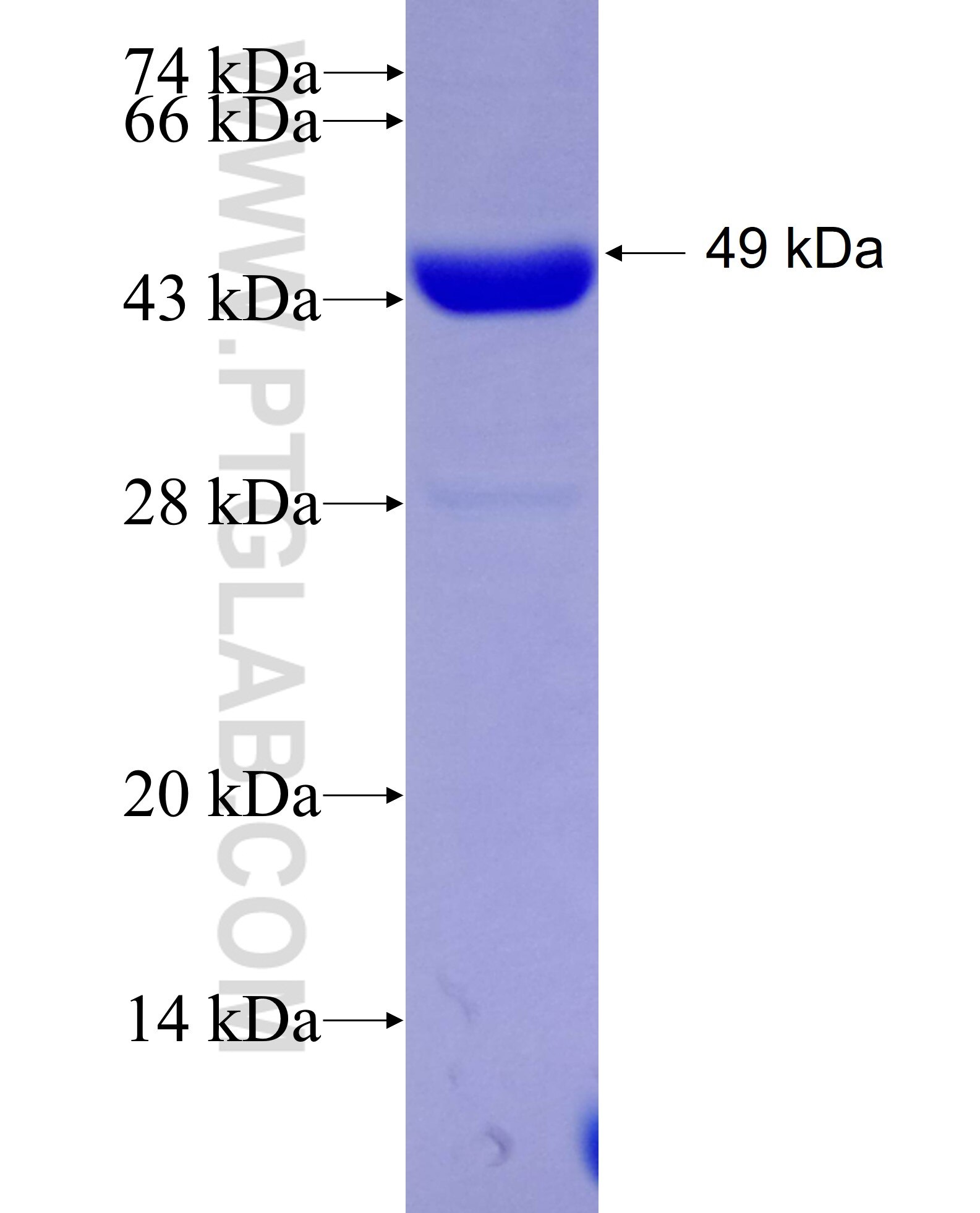 DCX fusion protein Ag29029 SDS-PAGE