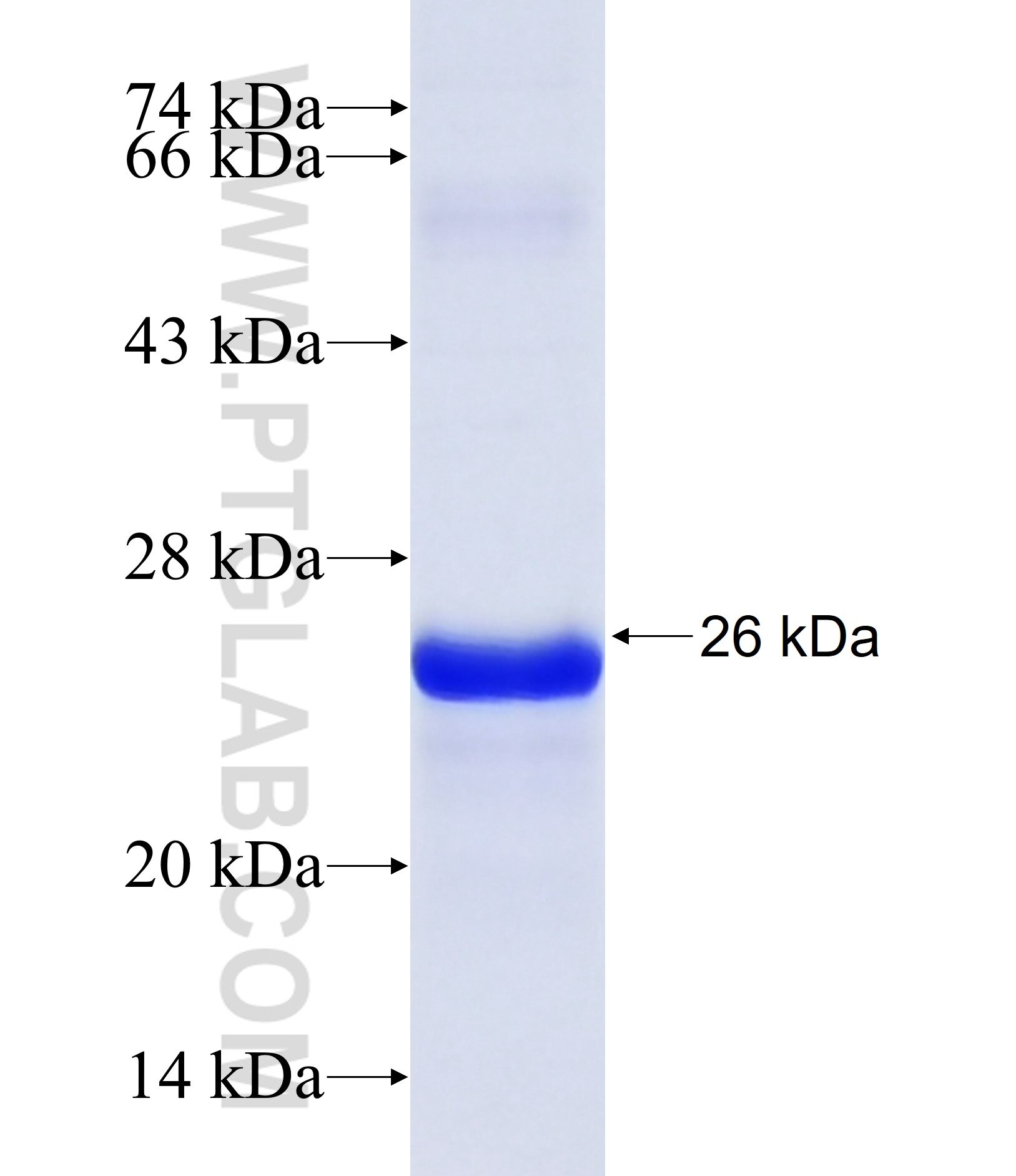 DCX fusion protein Ag29035 SDS-PAGE DCX fusion protein Ag29035 SDS-PAGE