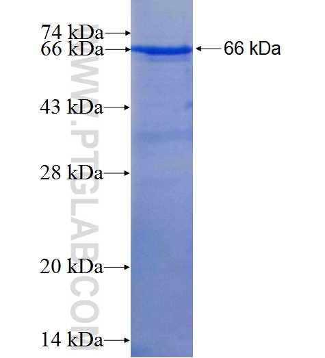DCX fusion protein Ag4945 SDS-PAGE