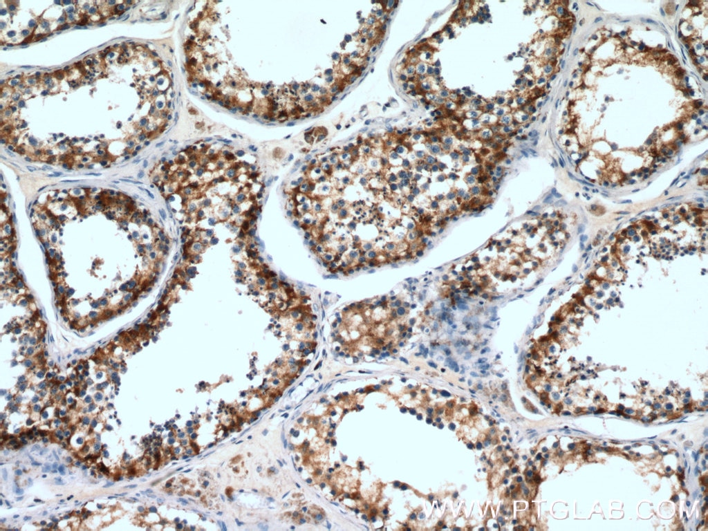 Immunohistochemistry (IHC) staining of human testis tissue using DCXR Polyclonal antibody (15188-1-AP)