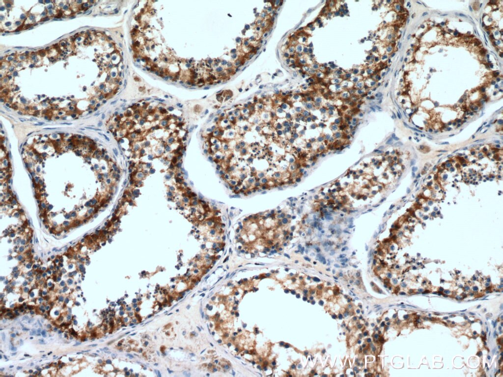 Immunohistochemistry (IHC) staining of human testis tissue using DCXR Polyclonal antibody (15188-1-AP)