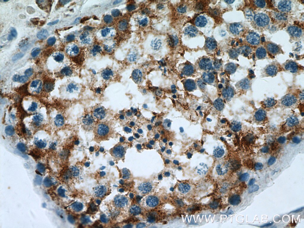 Immunohistochemistry (IHC) staining of human testis tissue using DCXR Polyclonal antibody (15188-1-AP)