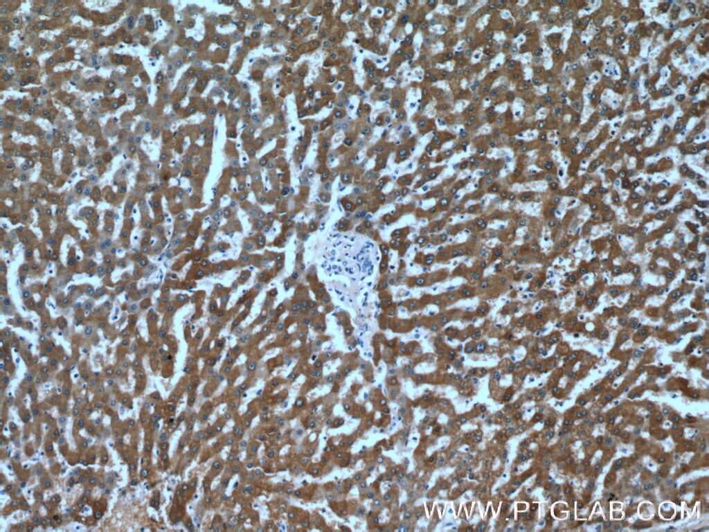 Immunohistochemistry (IHC) staining of human liver tissue using DCXR Polyclonal antibody (15188-1-AP)