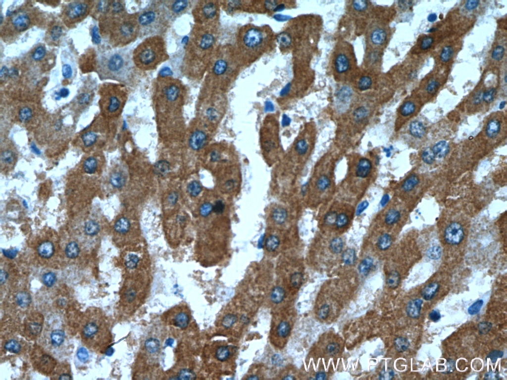 Immunohistochemistry (IHC) staining of human liver tissue using DCXR Polyclonal antibody (15188-1-AP)