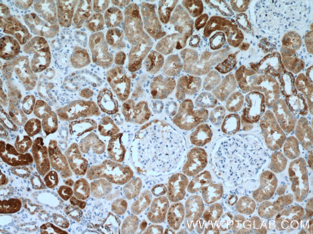 Immunohistochemistry (IHC) staining of human kidney tissue using DCXR Polyclonal antibody (15188-1-AP)