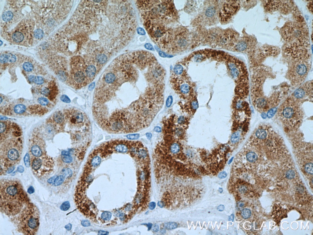 Immunohistochemistry (IHC) staining of human kidney tissue using DCXR Polyclonal antibody (15188-1-AP)