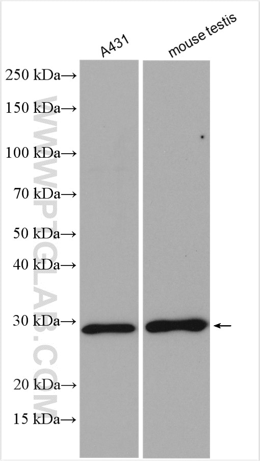 Western Blot (WB) analysis of various lysates using DCXR Polyclonal antibody (15188-1-AP)
