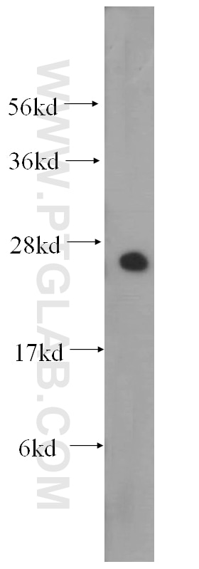 Western Blot (WB) analysis of human testis tissue using DCXR Polyclonal antibody (15188-1-AP)