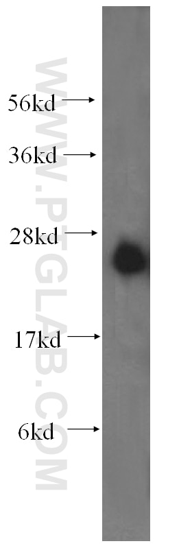 Western Blot (WB) analysis of human liver tissue using DCXR Polyclonal antibody (15188-1-AP)