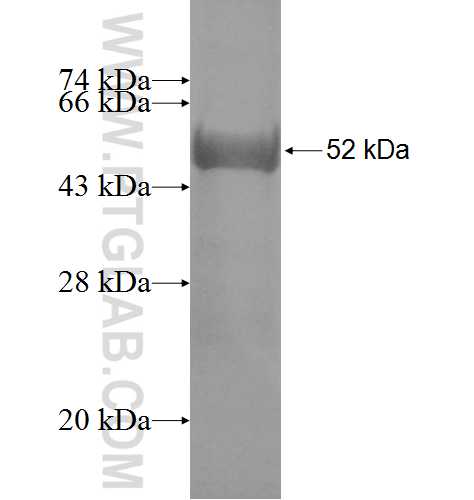DCXR fusion protein Ag7272 SDS-PAGE