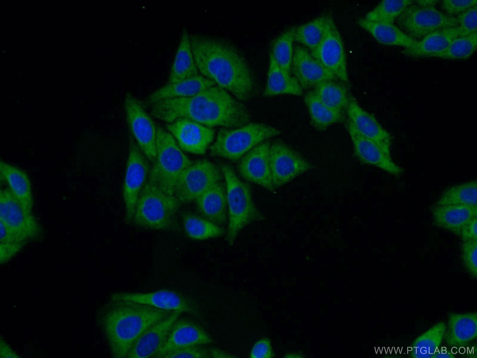 Immunofluorescence (IF) / fluorescent staining of HepG2 cells using DDA1 Polyclonal antibody (14995-1-AP)