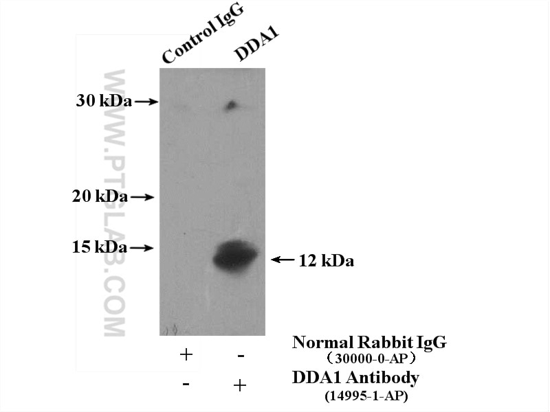 Immunoprecipitation (IP) experiment of HepG2 cells using DDA1 Polyclonal antibody (14995-1-AP)