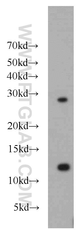 Western Blot (WB) analysis of HeLa cells using DDA1 Polyclonal antibody (14995-1-AP)