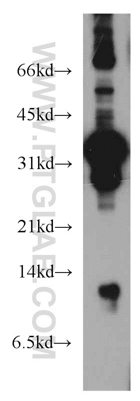 Western Blot (WB) analysis of mouse liver tissue using DDA1 Polyclonal antibody (14995-1-AP)