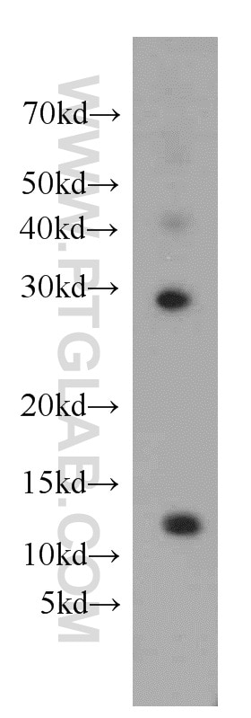Western Blot (WB) analysis of HepG2 cells using DDA1 Polyclonal antibody (14995-1-AP)