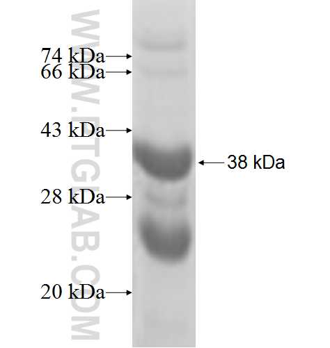 DDA1 fusion protein Ag6981 SDS-PAGE