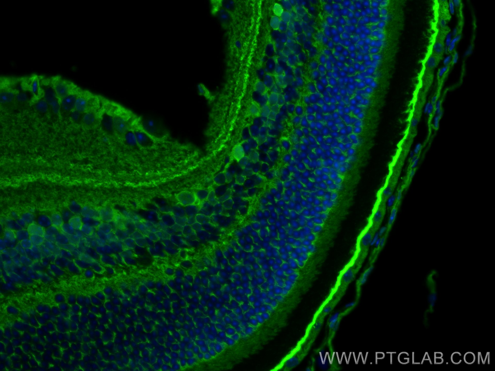 Immunofluorescence (IF) / fluorescent staining of mouse eye tissue using DDAH1 Polyclonal antibody (30108-1-AP)