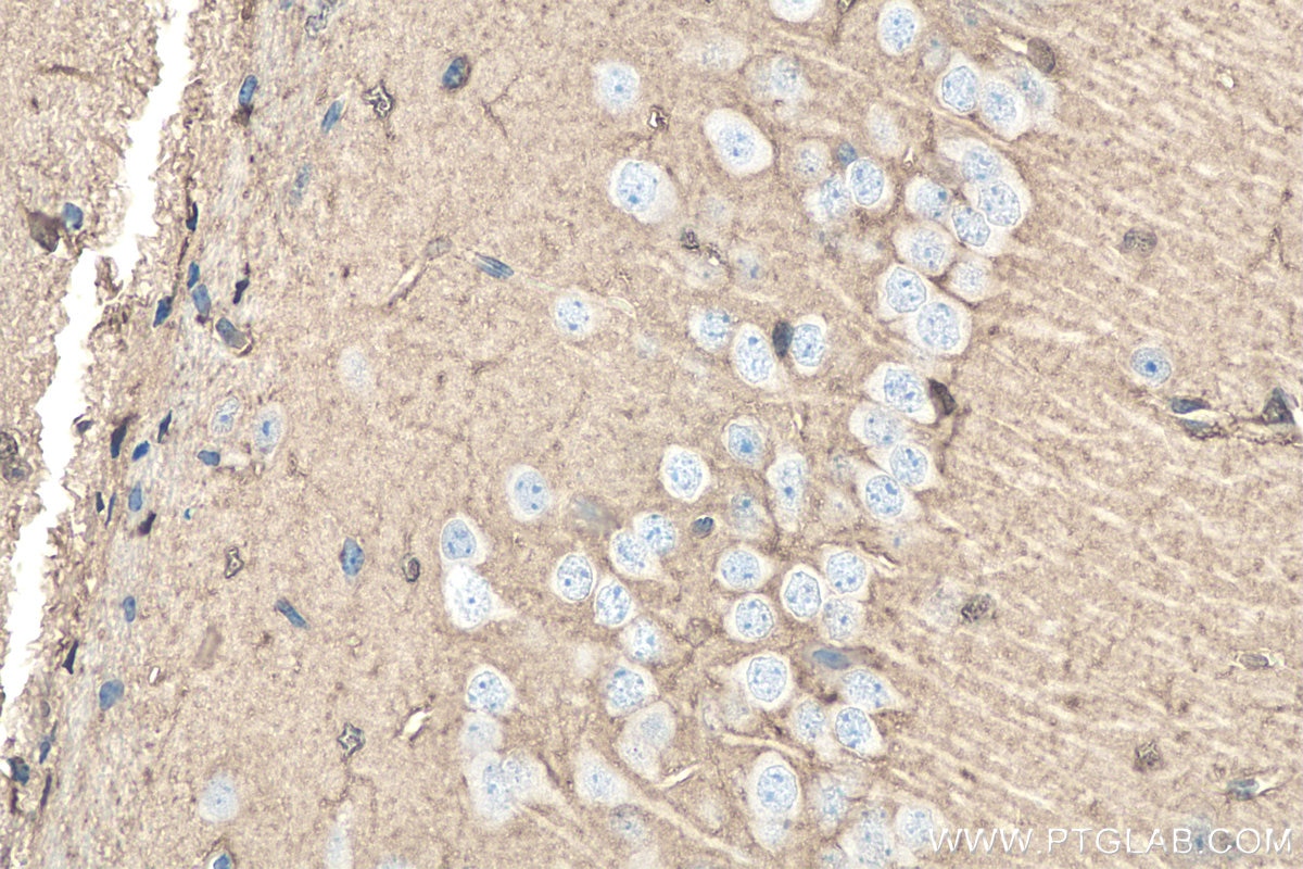 Immunohistochemistry (IHC) staining of mouse brain tissue using DDAH1 Polyclonal antibody (30108-1-AP)